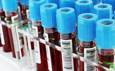 Blood Biomarkers for Use in Alzheimer Disease—Moving From “If” to “How?”