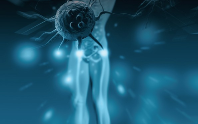 Joint Pain and Leisure-Time Physical Activity